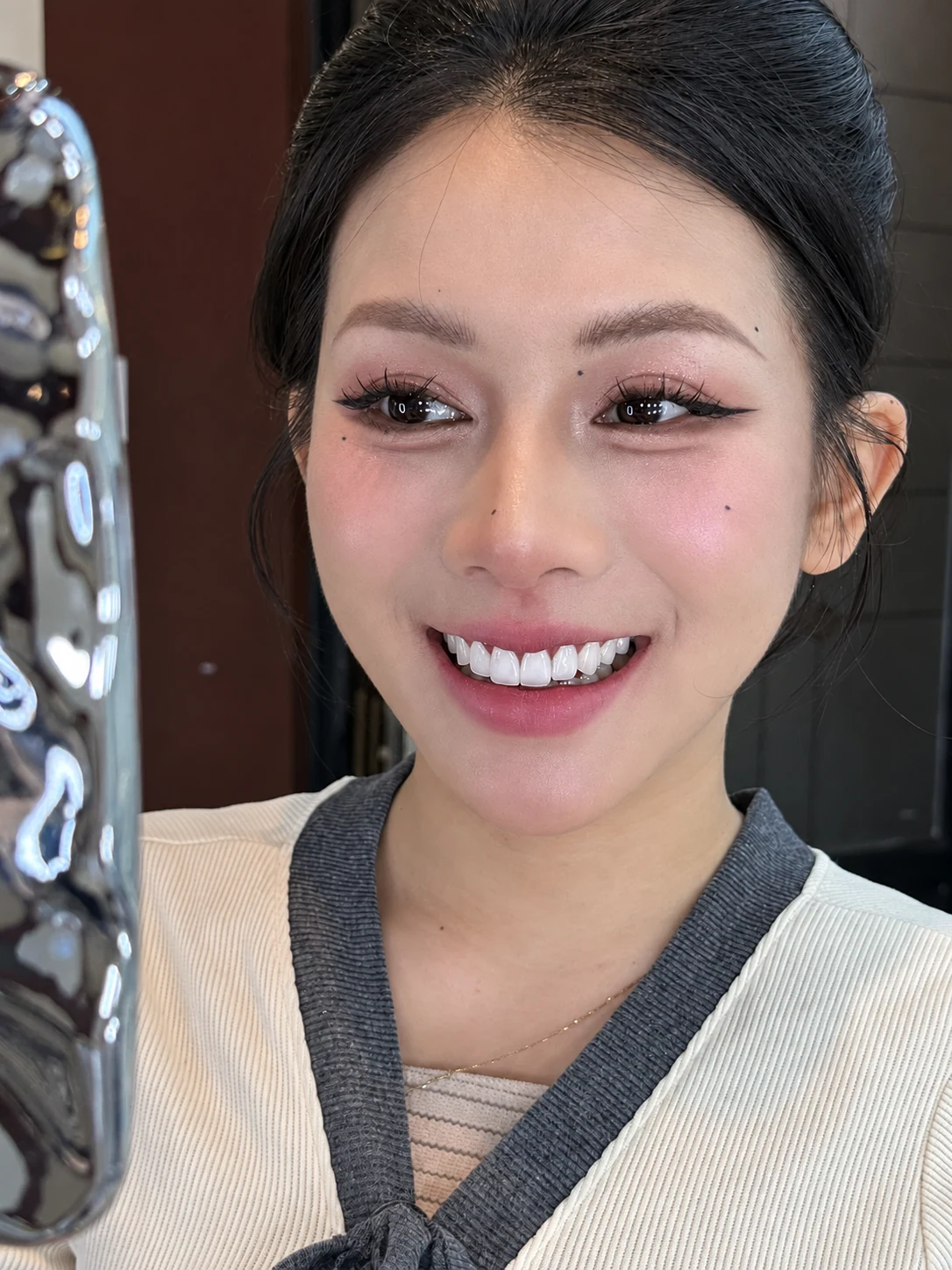 Nụ cười khách hàng Q Dentist – ảnh bổ sung thứ 10