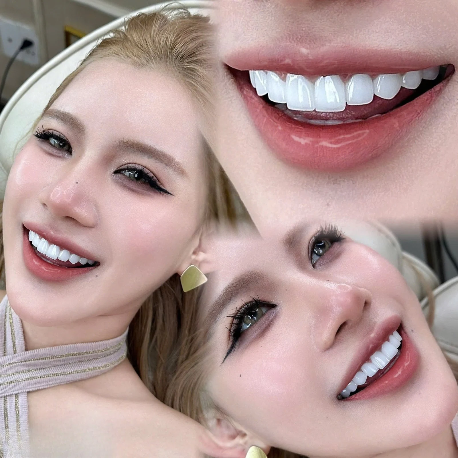 Cận cảnh nụ cười khách hàng – hình 30