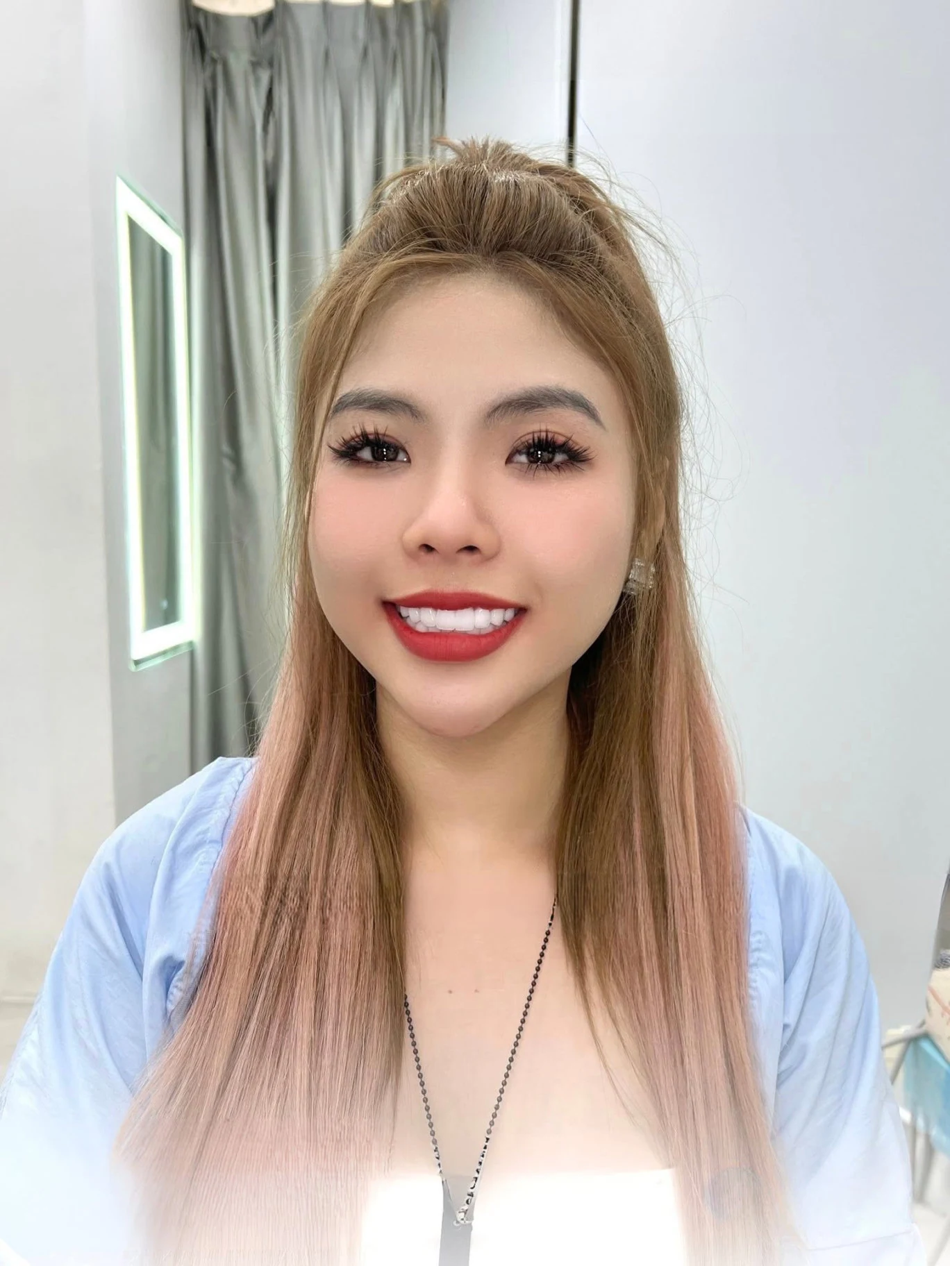 Nụ cười khách hàng tại Q Dentist – hình 38
