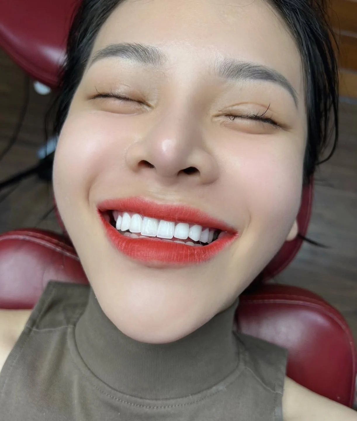 Nụ cười khách hàng tại Q Dentist – hình 37
