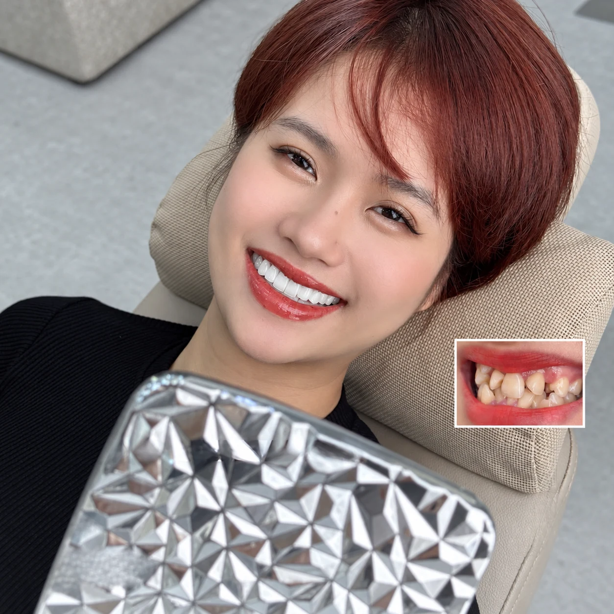 Hành trình thay đổi nụ cười – ảnh 12