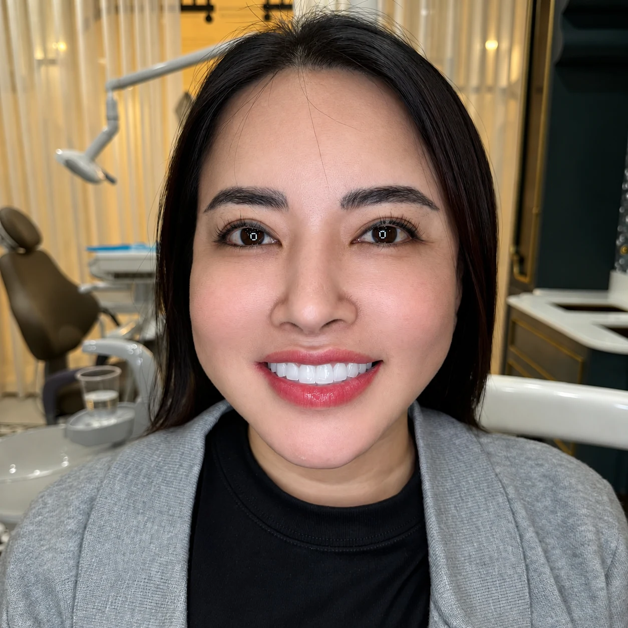 Khoảnh khắc rạng rỡ tại Q Dentist – ảnh mới 2