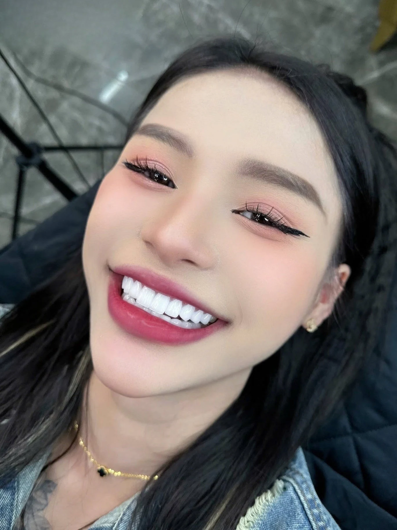 Nụ cười khách hàng tại Q Dentist – hình 27