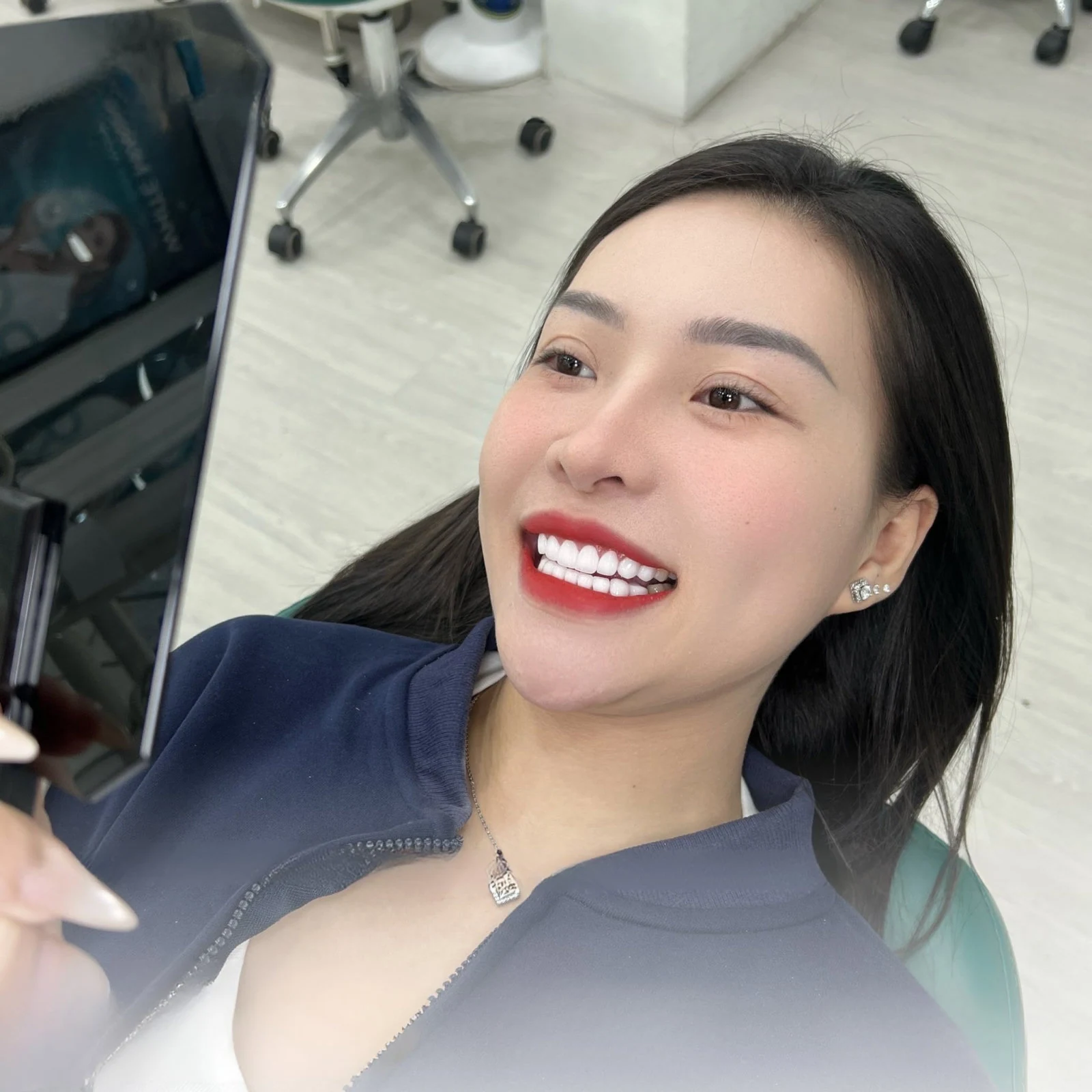 Nụ cười khách hàng tại Q Dentist – hình 29