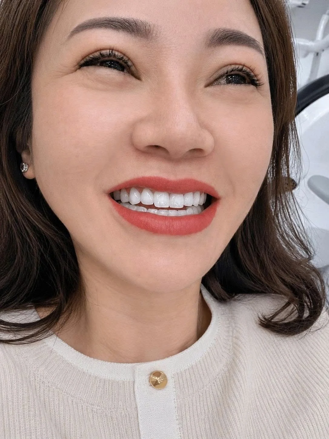 Nụ cười khách hàng tại Q Dentist – hình 26