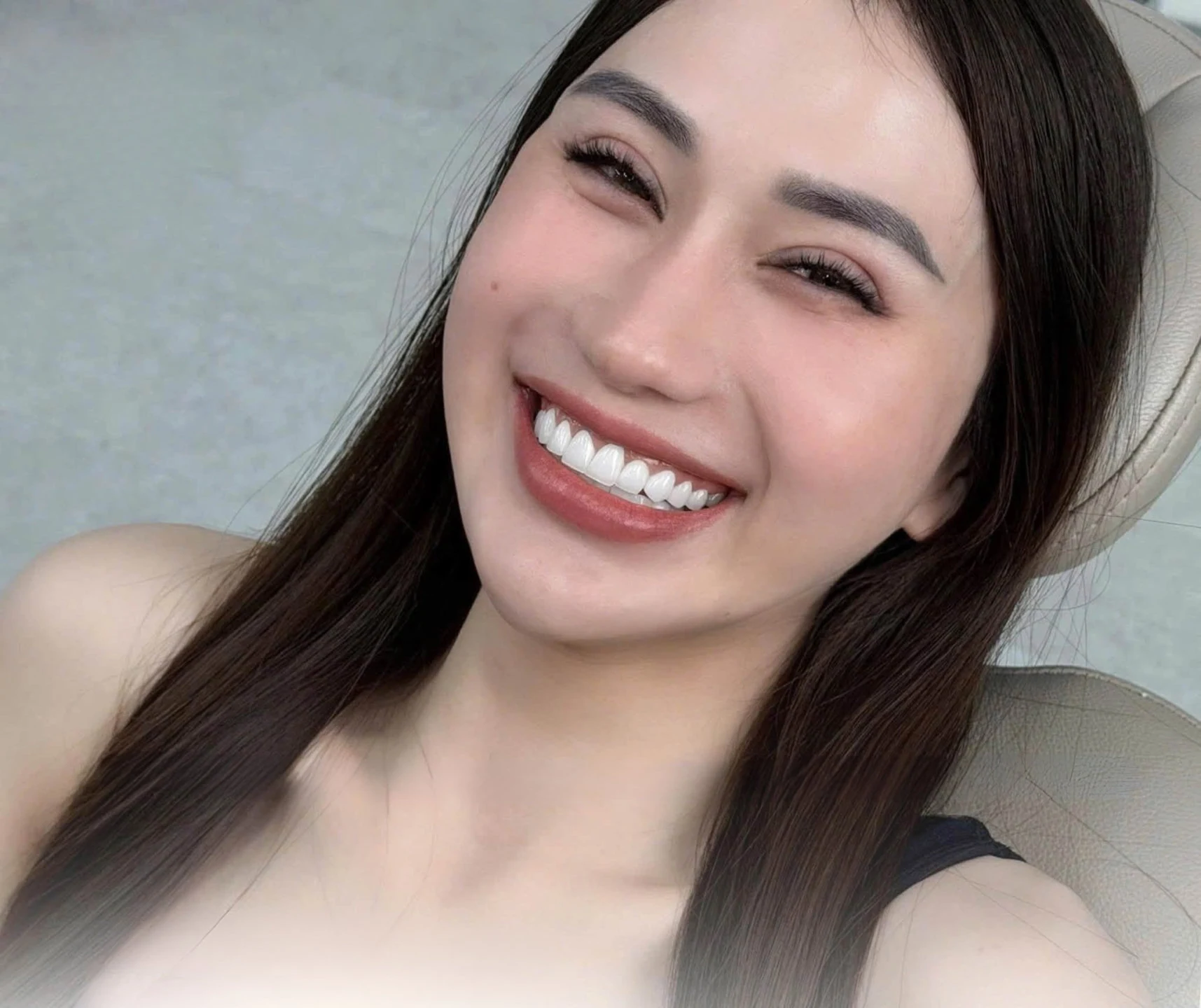 Nụ cười khách hàng tại Q Dentist – hình 25